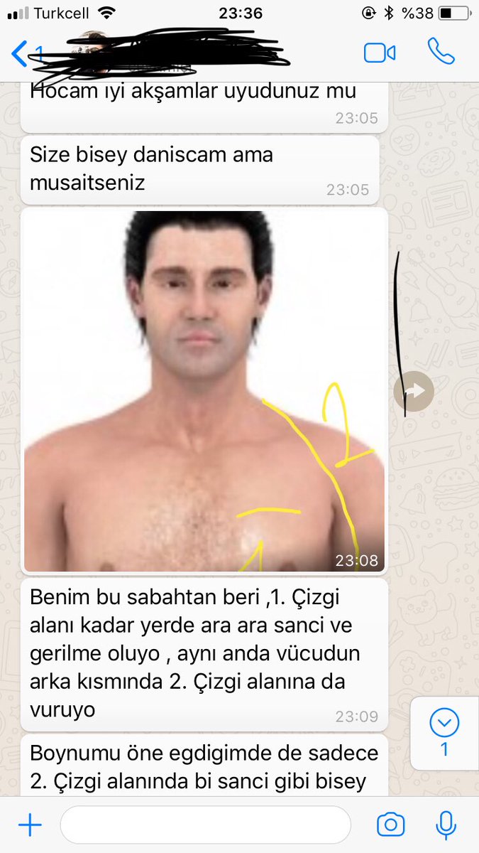 drhasanyucel's tweet photo. Böğrüne yel girse nasıl anlatacaktın acaba...hastalarım kendini aştı https://t.co/HnXBwKVBf9