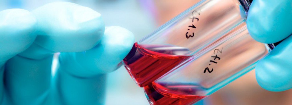 HoltonTech's tweet image. #PartnerBlog Discover how we are helping Ferring&apos;s Global Pharmaceutical R&amp;amp;D group to look deeply into vast scientific research data sets in order to generate new insights and accelerate innovation thanks to our partnership with Sinequa #AI …