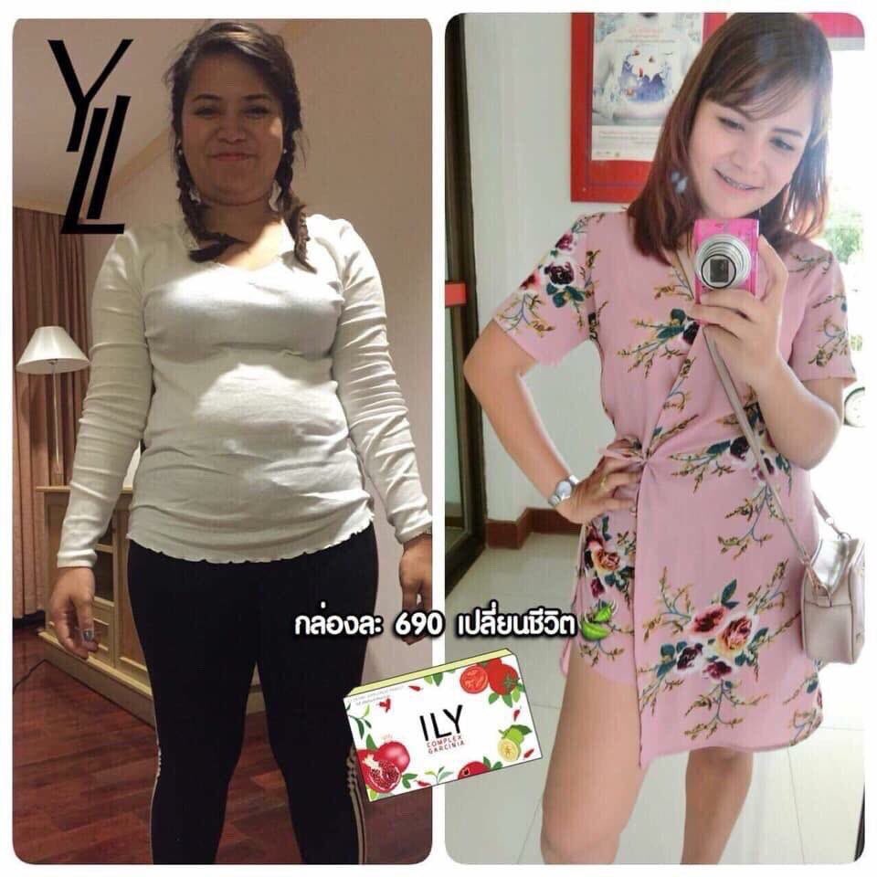 ilybymild's tweet photo. ไม่พูดมาก ให้ภาพมันเล่าเรื่อง  ลดจริงไม่จกตา กล้าเคลมเลยดื้อยาแค่ไหนก็ลด #ILY 

💚 คลิ๊ก 👉🏻 https://t.co/6aCSjPUVVc https://t.co/IshgPhIpGZ