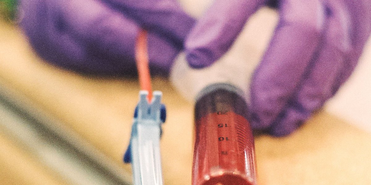 clinicalmeets's tweet photo. Gain Knowledge on Cancer ... ClinicalOncology :- https://t.co/LGZ9jpZAat
Stimulating the Immune System Shrinks Some Slow-Growing #Lymphomas.
#Causes_of_cancer #CancerMetastasis #OrganSpecificCancer #BloodCancer #LungCancer #BloodCancer #SkinCancer #Melanomas https://t.co/uTQzkxJkKu