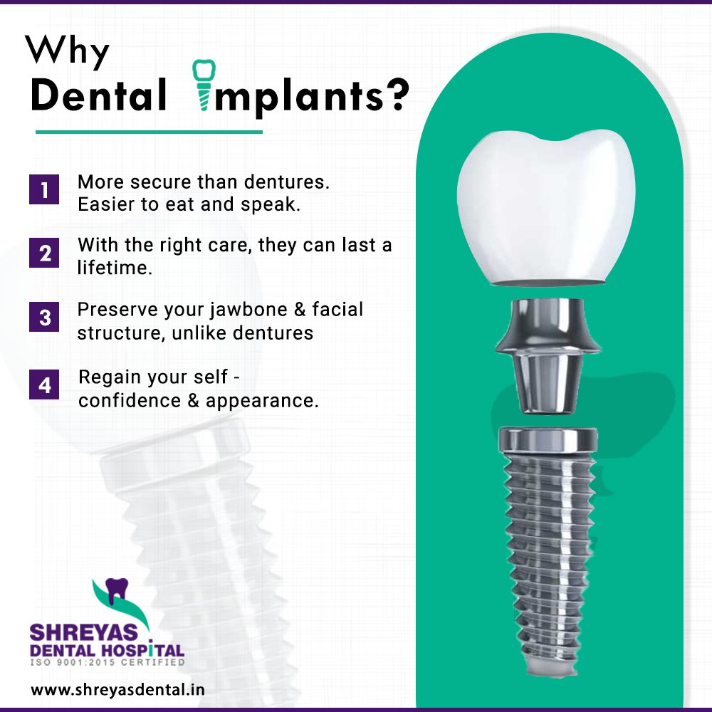 shreyas_dental's tweet image. Why should you go for the Dental Implant treatment?
Here are some advantages of Dental Implants. 

Book your appointment: 📞 +91-9712994608
Visit: shreyasdental.in/dental-implant…

#DentalImplant #DentalImplantsSpecialist #BasalImplants #Ahmedabad