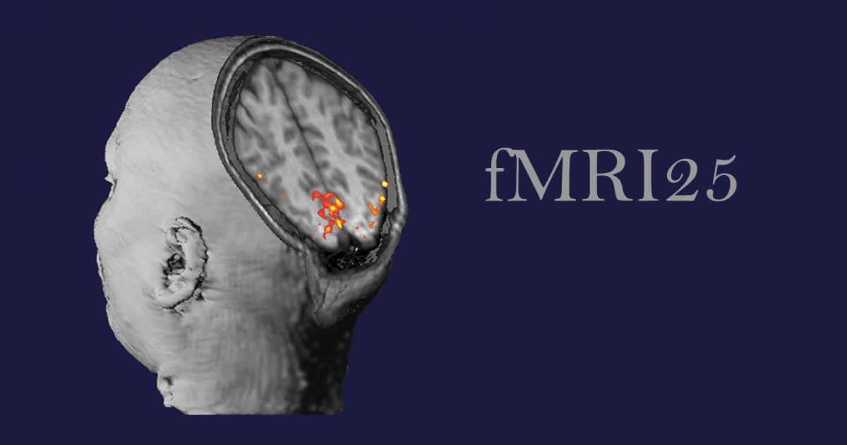 MGHMartinos's tweet photo. Do you like #fMRI? Do you like learning about stuff? If so, check out the revamped #fMRI25 website. Read in-depth articles about the origins of the technique in the #MGH Martinos Center, watch video from the fMRI25 symposium, and more! https://t.co/aXXj8vHiEU. #MRI https://t.co/8rJMpIc1pz