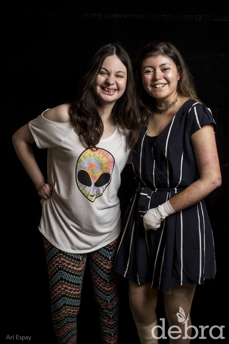 debraOfAmerica's tweet photo. "I wish I didn't have to explain my illness, period. But as I've grown, I've realized that the only &amp; most efficient way to properly raise awareness is through explaining." - Ariana (right). Read Ariana &amp; Bianca's #EverydayEB stories in honor of #EBweek: https://t.co/GVkqCOZ9Ag https://t.co/mZPheFw1en