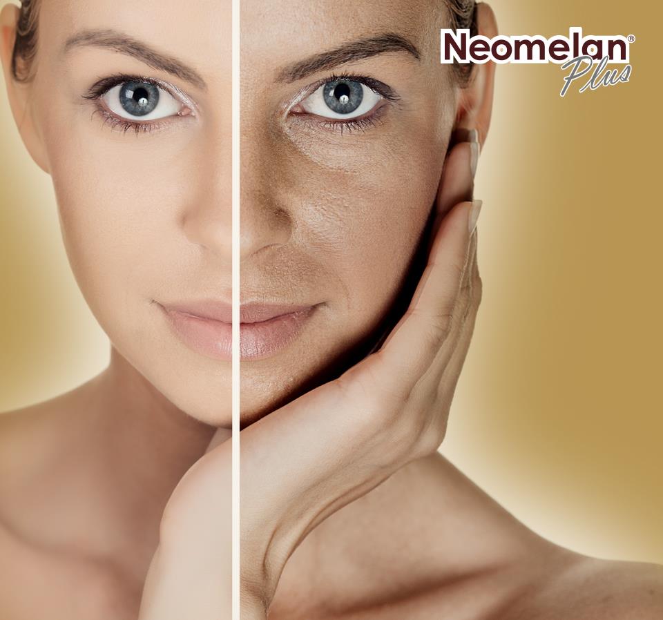 Mercadermo's tweet photo. #Neomelan Plus, aclara y reduce la intensidad de las #manchas producidas por diferentes factores como: #cloasma, #léntigo senil, #pecas por exposición solar, #manchas por #anticonceptivos, prevención y tratamiento de las pigmentaciones #post-peeling. https://t.co/wLWvA41SbJ https://t.co/gZVC0x2XqI