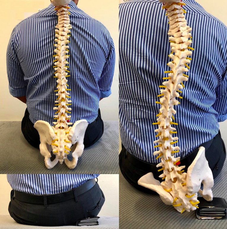 DrVoithofer's tweet photo. How's your #posture? We offer #StretchTherapy @ our #OmahaChiropractic #PainManagementClinic to relieve #pain, improve mobility, relieve stress, promote circulation &amp; more. More info: https://t.co/BGCd9kReDP #Omaha #Chiropractor #CheckYourPosture https://t.co/Hr1lRGbd8G