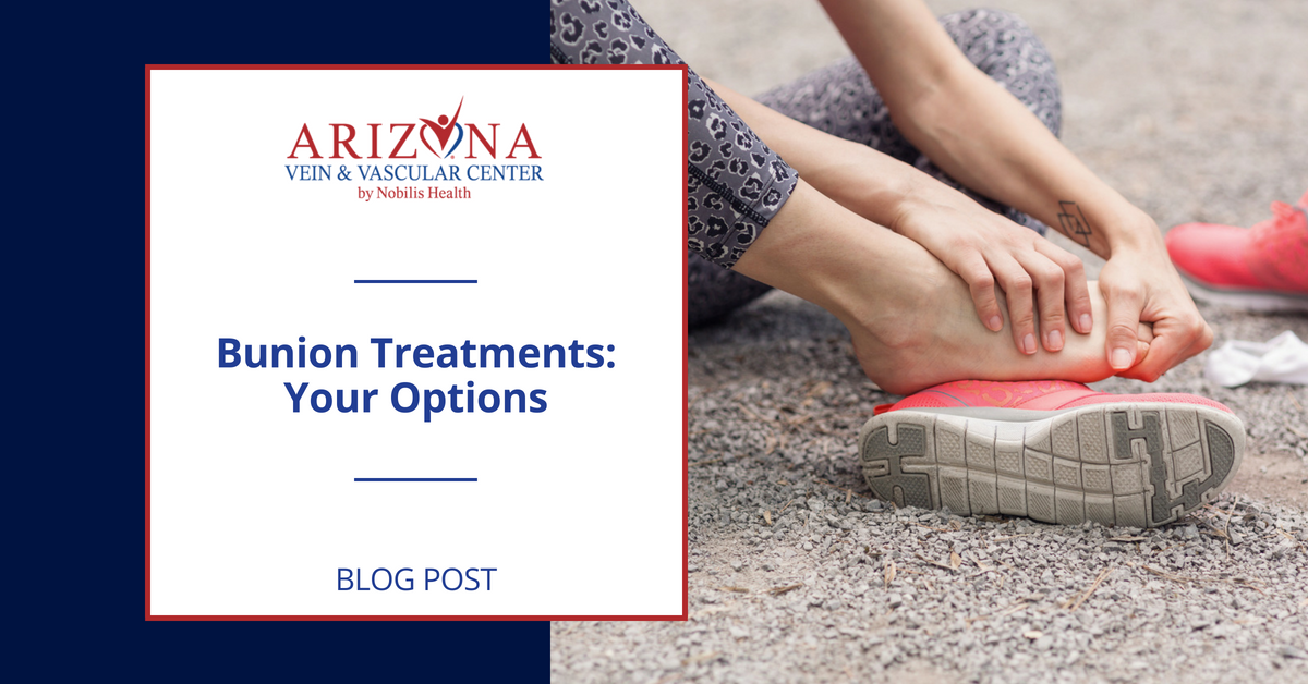 ArizonaVascular's tweet photo. #Bunions can be disfiguring and painful. Luckily, there are a range of approaches to managing and treating them: https://t.co/bLJlPZAaHl https://t.co/u2u25RhpiT
