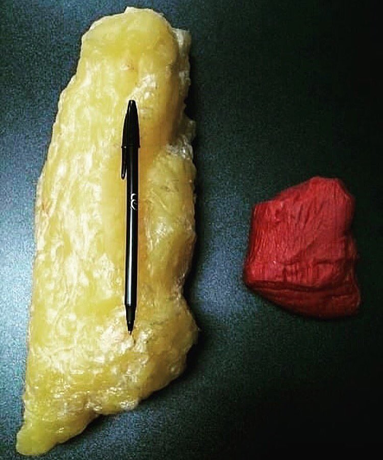 GainersClub's tweet image. 5lbs of fat VS 5lbs of muscle❗️😵
CHOOSE WISELY❗️
#GAINERSCLUB #GAINS #HEALTHYLIVING #POWER #STRENGTH #GAINS