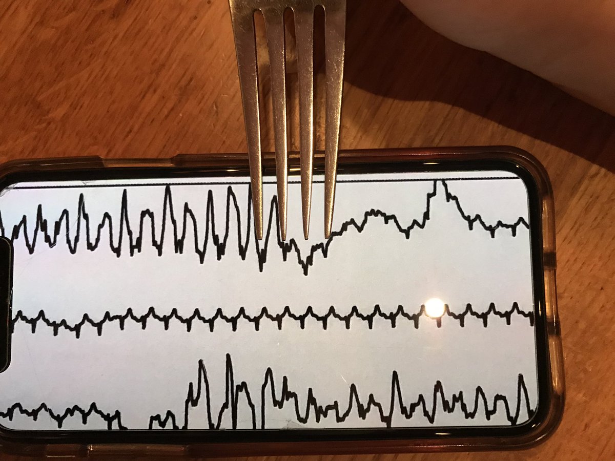 50wattdoc's tweet photo. Out-of-town and out-to-lunch on when I receive a curbside text from a friend. #forkcalipers to the rescue! 😂 #EPnerd 🤓 @EPeeps_Bot https://t.co/6Ebu9UvhMb