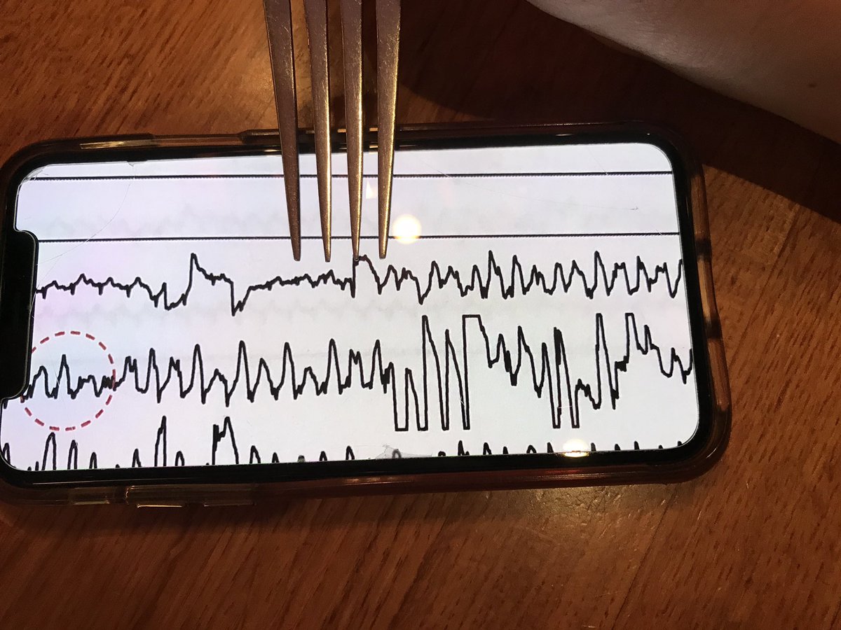 50wattdoc's tweet photo. Out-of-town and out-to-lunch on when I receive a curbside text from a friend. #forkcalipers to the rescue! 😂 #EPnerd 🤓 @EPeeps_Bot https://t.co/6Ebu9UvhMb