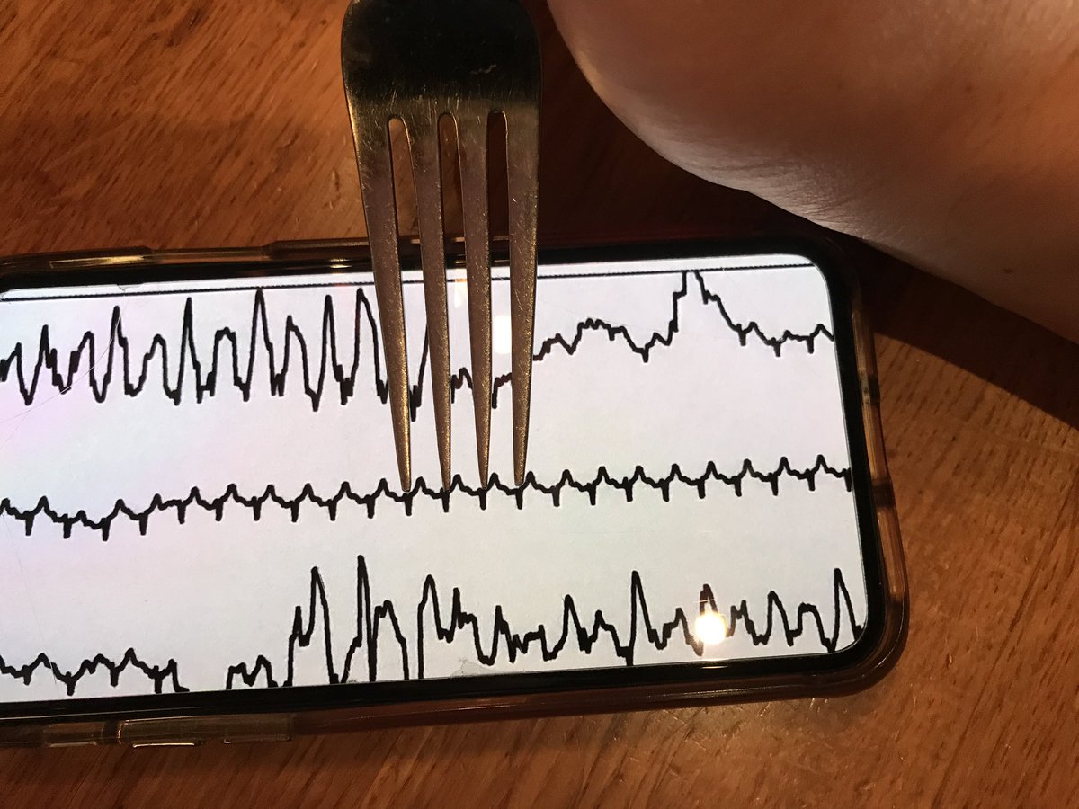 50wattdoc's tweet photo. Out-of-town and out-to-lunch on when I receive a curbside text from a friend. #forkcalipers to the rescue! 😂 #EPnerd 🤓 @EPeeps_Bot https://t.co/6Ebu9UvhMb