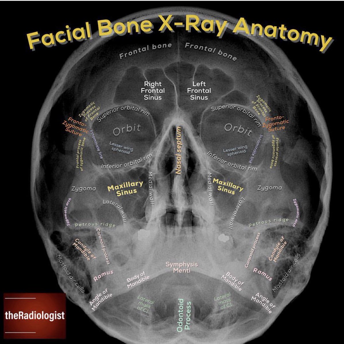 X Ray Skull Views