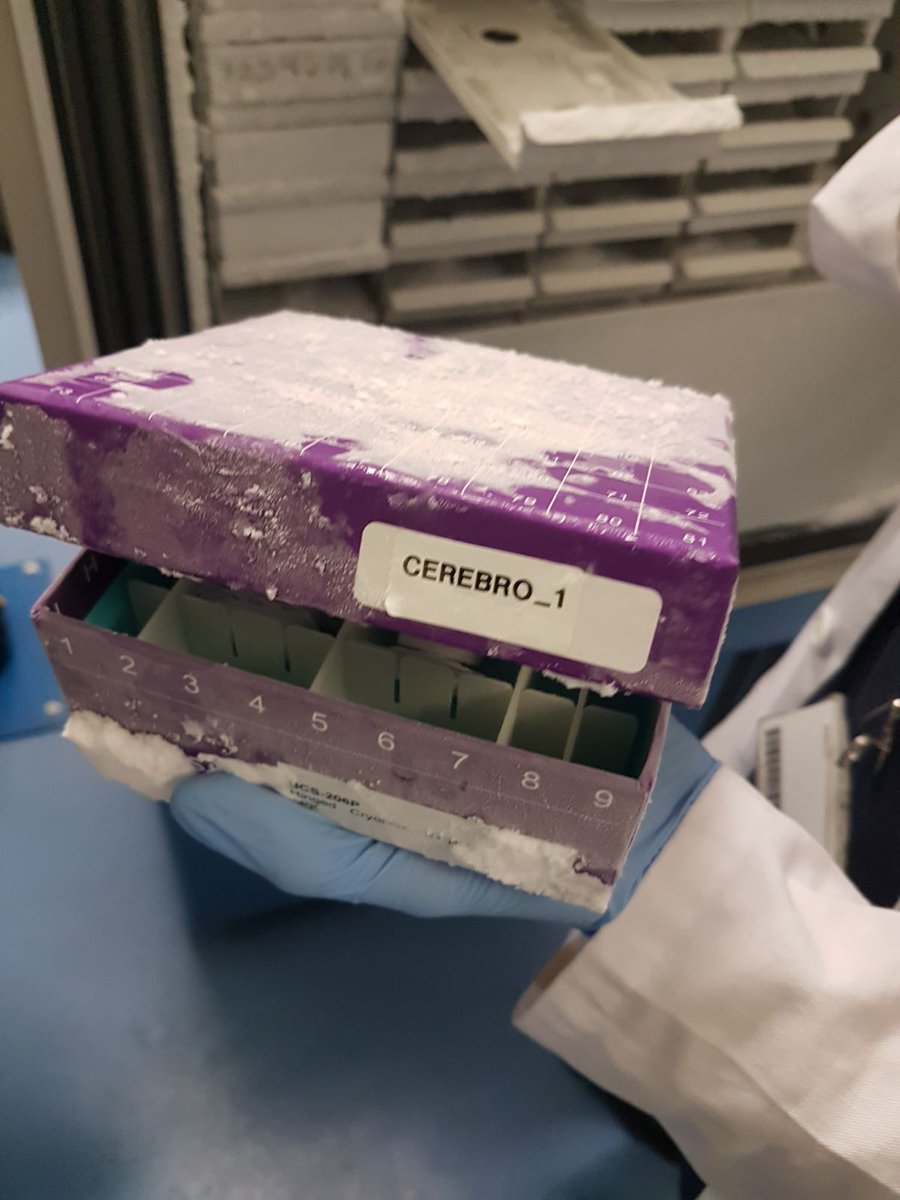 IISLaFe's tweet photo. 🧠Entraremos en un banco de ciencia donde os explicarán cómo almacenan las muestras biológicas para su uso en investigación biomédica. Es el @biobancolafe y su equipo os contará, entre otras muchas cosas, para qué sirve un banco de cerebros. #NitCiènciaCV
#ScienceBridges https://t.co/etWQlgfVPb