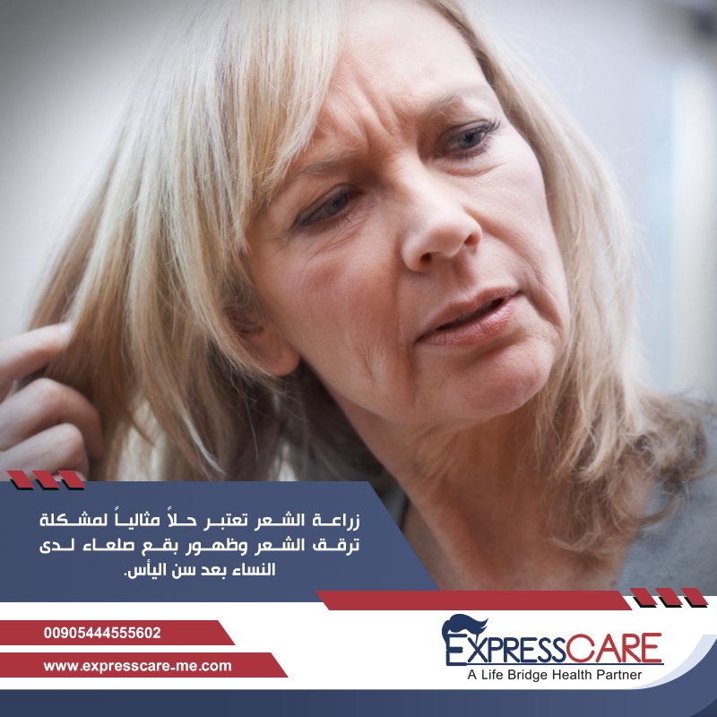 TheExpresscare's tweet photo. يعتبر #تساقط_الشعر من أكبر المشكلات التي تواجه النساء في #سن_اليأس 
#زراعة_الشعر تساعدك في تجاوز سن الياس بسلام 
#زراعة_الشعر_للنساء
#علاج_الصلع
#اكسبرس_كير https://t.co/8yuQObFCvI