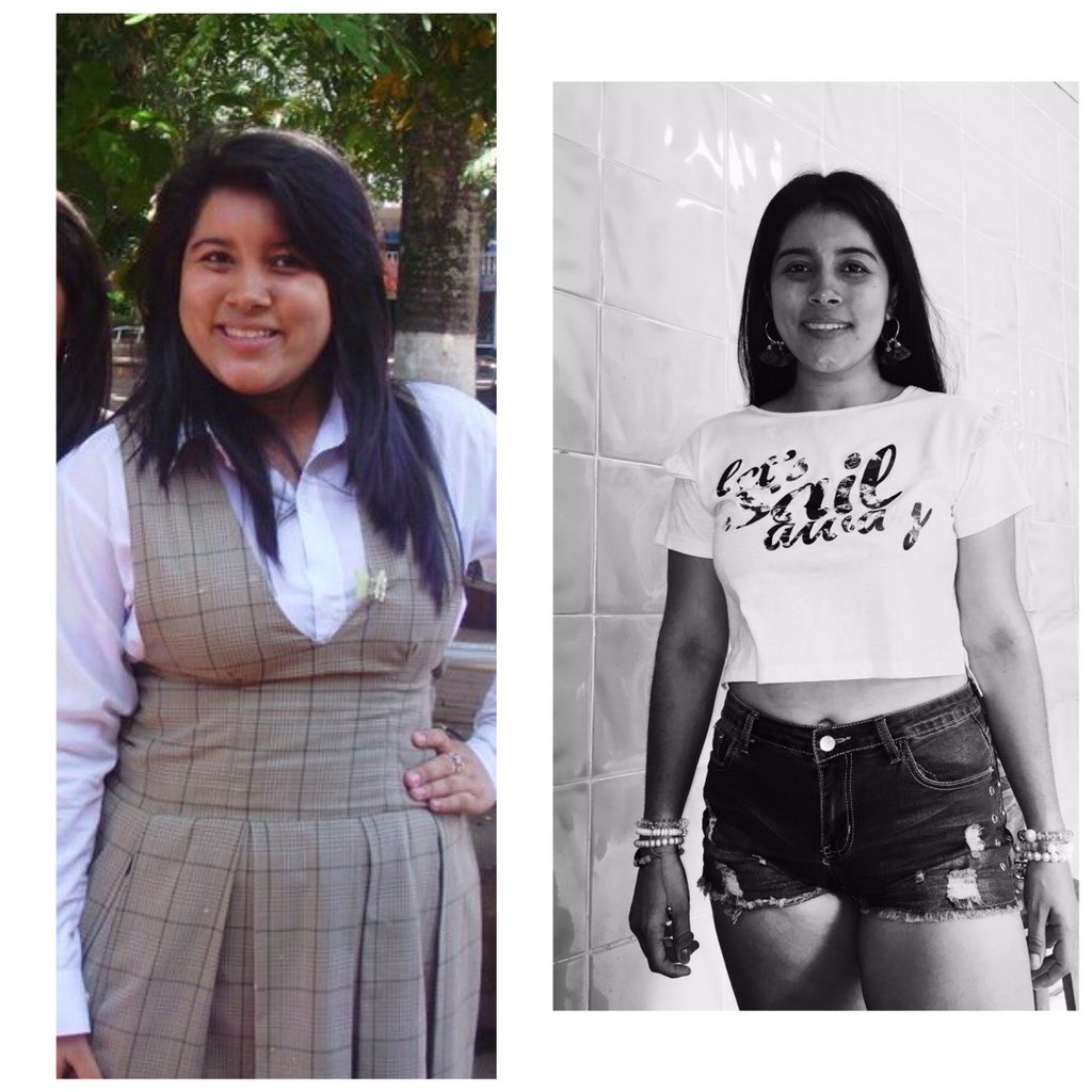 kadapihe_'s tweet photo. Y si, estás soy YO ( mi antes y el ahora ). Me siento muy orgullosa de lo que logré y de lo que soy ahora( no es fácil, pero tampoco IMPOSIBLE) . Sin duda Gracias al mejor de todos @ObesidadAlej  porque sin tu ayuda nada de esto hubiera sido posible 💁🏻‍♀️🙅🏻‍♀️🙏 https://t.co/NCEBGURPex