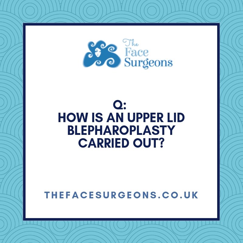 thefacesurgeons's tweet photo. How is an upper lid #blepharoplasty carried out? What happens after an upper lid blepharoplasty? What should I do prior to surgery? 

Find out the answers to your upper blepharoplasty surgery questions here: https://t.co/HxWjoiRgnM

#meded #eyelidsurgery #eyelids #uppereyelids https://t.co/TsE5RJfymP