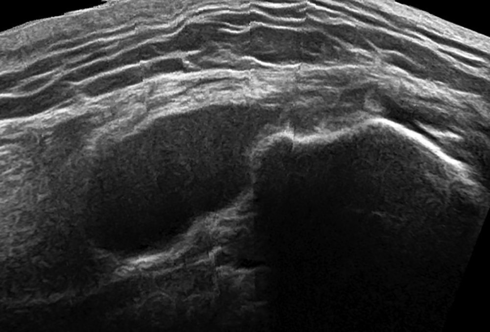 MSK Ultrasound tweet media