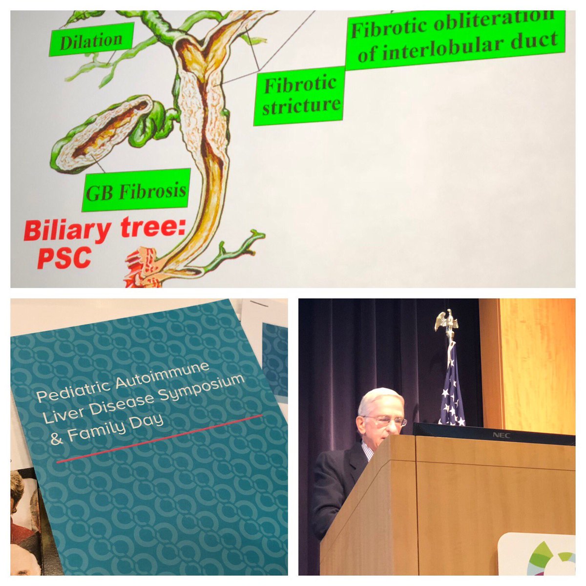 CincyKidsCALD's tweet photo. Kicking off the 2nd Pediatric Autoimmune Liver Disease Symposium &amp; Family Day at CCHMC with a primer on AILD by Dr. Bill Balistreri #PSC #AIH https://t.co/iIdk71jWX7