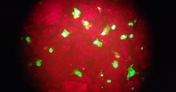 LetsFaceItCare's tweet photo. "#APNewsBreak: 80,000 People Died of #Flu Last Winter in U.S."
https://t.co/qBeKh6FuCG
#LatestHealthCareNews https://t.co/CtmZ1hmJSw