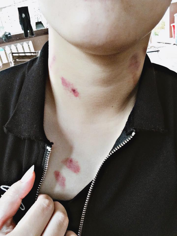 ookk07oo's tweet photo. บอกไม่ทัน งดออ��บ้าน https://t.co/airvSr1kPO