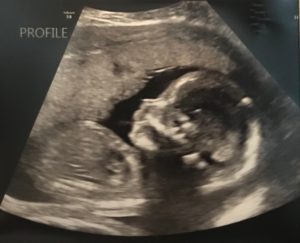 mreeder5's tweet photo. Little Hiccups and Major Kicks https://t.co/4m4C1KN7zl https://t.co/C5LuTfr6hW