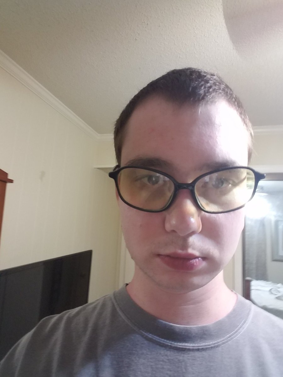 HitStunGaming's tweet photo. A burnt face of pain. https://t.co/I6rtZOCneE