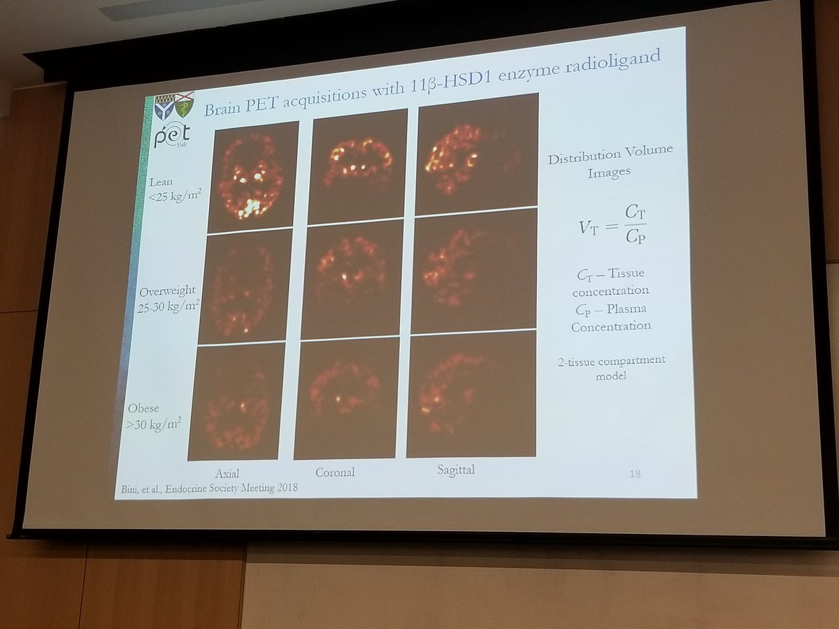 A new PET tracer highly specific to cortisol expression shows correlation between cortisol in the brain and body mass - according to <a href="/ScienceDrBini/">Jason Bini, PhD</a>  from <a href="/Yale/">Yale University</a> <a href="/YaleRadiology/">Yale Department of Radiology & Biomedical Imaging</a> <a href="/YalePET/">YalePETImagingCenter</a> @ZibaKashef #ImagingElevated2018