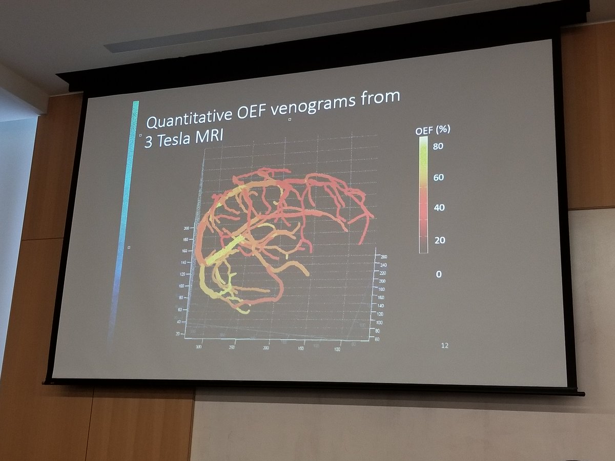 Dr. Audrey Fan from <a href="/StanfordRad/">Stanford Radiology</a> uses MRI susceptibility maps in a novel way to generate oxygenation maps of blood vessels in the brain for classifying strokes <a href="/Stanford/">Stanford University</a> <a href="/StanfordBrain/">Wu Tsai Neurosciences Institute</a> @sciencenathan @amaykristinadams <a href="/Taylor_Kubota/">Taylor Kubota</a> #ImagingElevated2018