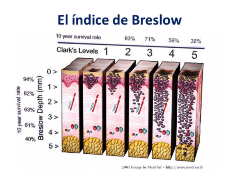 resonarte_8a's tweet photo. #ECOMED2018 #SonoTips el indice de Breslow y Clark se emplea para clasificar las lesiones cutáneas malignas según su profundidad @avum_ecomed https://t.co/uYNuHX3MEy
