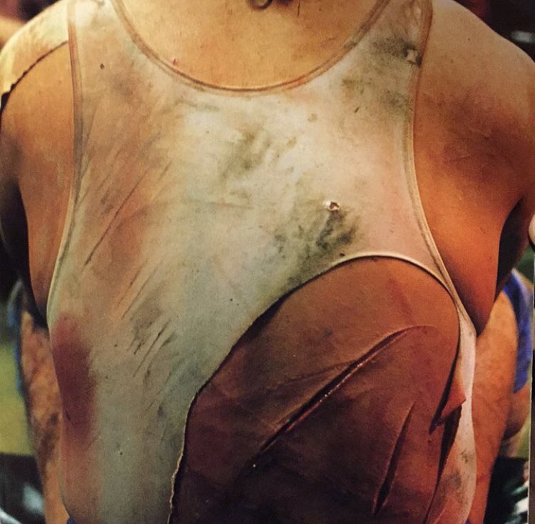 ShamansWorld1's tweet photo. Jesus look at these slices on Onitas back after a match. And people say it’s fake...That’s going to leave some insane scars!! Onita gave it his all for the wrestling business  #fmwwrestling #onita #japanesewrestling #hardcore #deathmatch #barbwire #oldschoolwrestling https://t.co/IuJhvowRlF