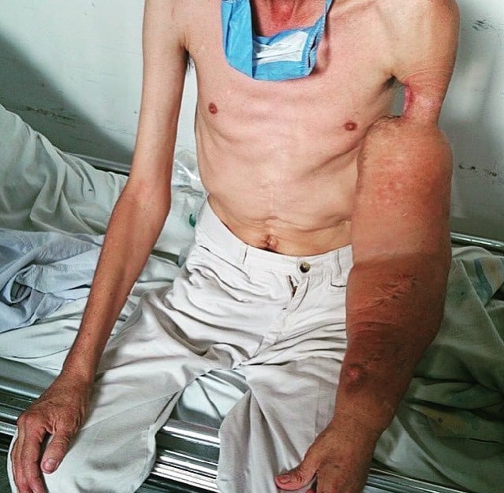 medicine_worlds's tweet photo. A Case of lymphadenopathy 🙁 !! https://t.co/pKjFE6TkrT