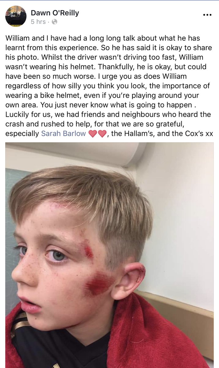 GrahamPicker's tweet photo. Friend of mine’s son.  Please read and take note. @nottsfire #luckyescape https://t.co/4BEDYAc7SZ