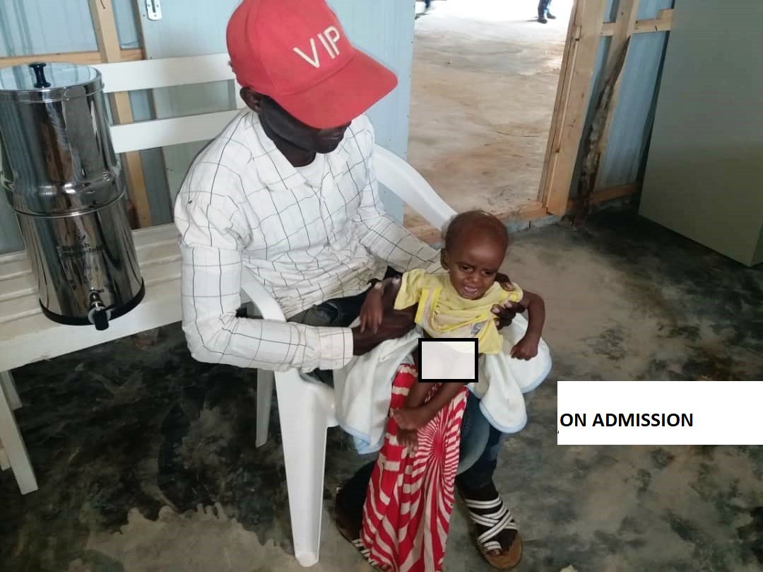 CPD_Africa's tweet photo. Upto 1.2 million Children <5 in Somalia are acutely malnourished making them 9 times more likely to die of killer diseases like acute watery diarrhoea/cholera &amp; measles. With the support of @shf_somalia, we continue to save children like Ibrahim with therapeutic treatment for SAM https://t.co/osuajFdQSY