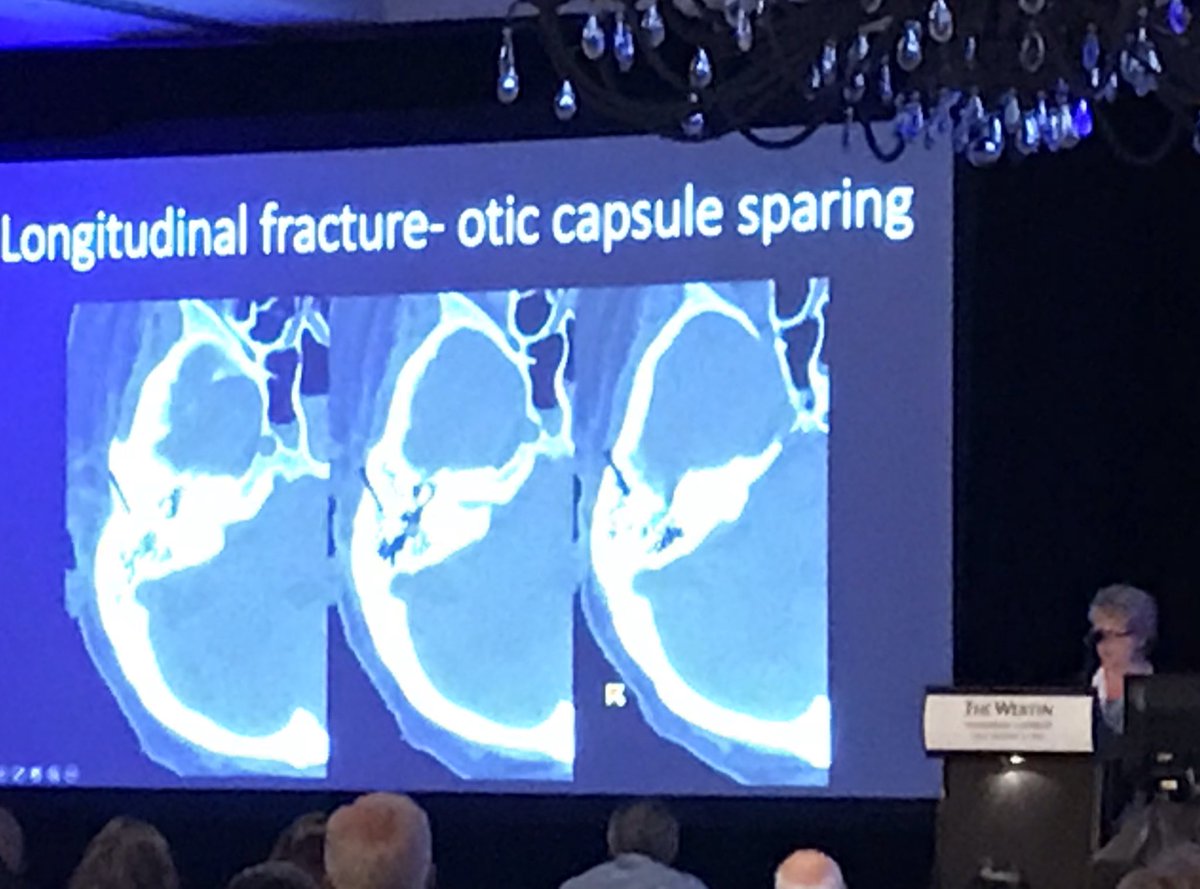 CDP_Rad's tweet photo. Last day of the very successful #ASHNR18 with @beccacornel (Past President) teaching on T-bone trauma. @ASHNRSociety @DShatzkes https://t.co/kEDEBOqCfy