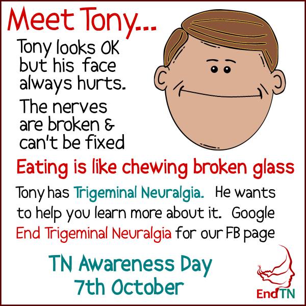 Check out the Tina and Tony album on Facebook. Share the pics to make them trend. Remember to use the hashtags.#MeetTina #MeetTony #TrigeminalNeuralgia facebook.com/pg/endTrigemin…
