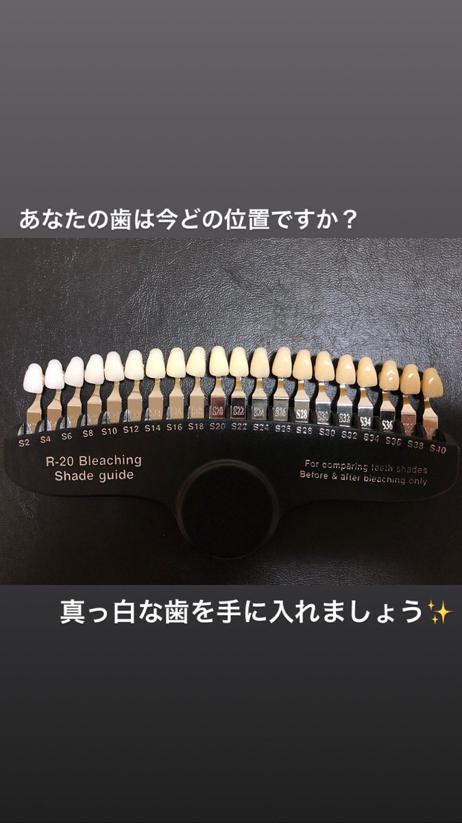 BlancheOkayama's tweet photo. 今一度自分の歯の色を見てみてください‼️
白い歯になれば印象も良くなります✨
他人から歯が白い❗️って言われますよ✨
自然な白さ、元の歯の色に戻したい方は是非ご連絡を‼️
完全予約制、24時間営業です👍 https://t.co/k4EecG6M7F
