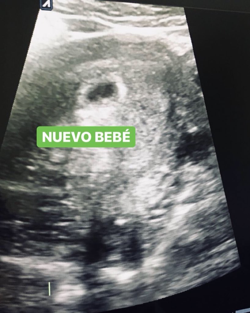 AMartinez_17's tweet photo. Sin duda los tiempos de Dios son perfectos!Durante estos años de casados ha sido una bendición poder disfrutar muchos momentos a tu lado.Ahora nos toca vivir una etapa más.Seremos papás algo q no se compara con nada y sin duda el mejor regalo.#LosAmo #SiempreJuntos ❤️🙏🏼👶🏻👪 https://t.co/ETo5iomyEu