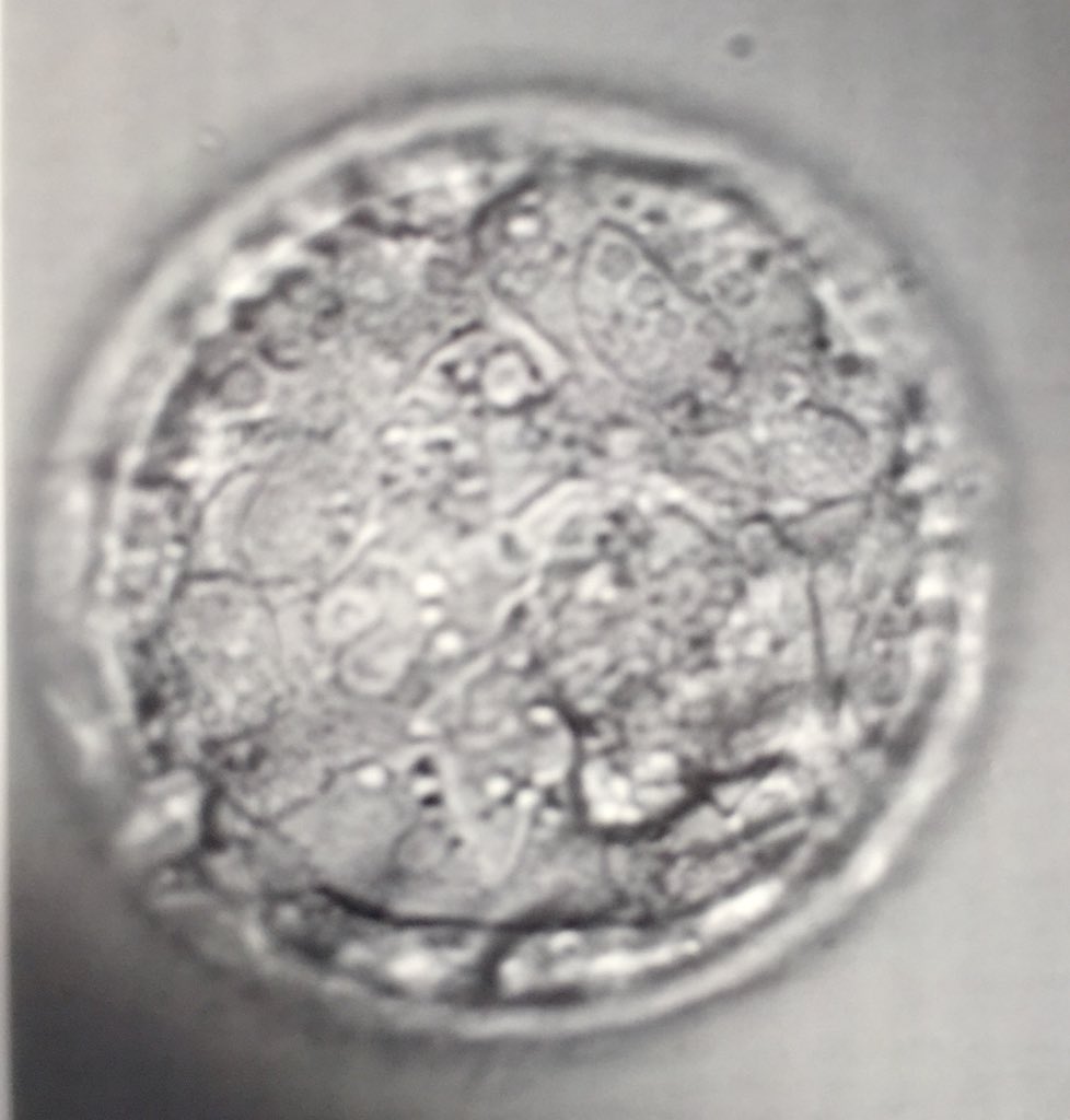 DoveEmma's tweet photo. New member of Team Dove expected to make an appearance April 2019. Science is bloody amazing! #IVF #DonorBaby #LittleFrostie #FET #SpermDonor https://t.co/Abu4T69YeW