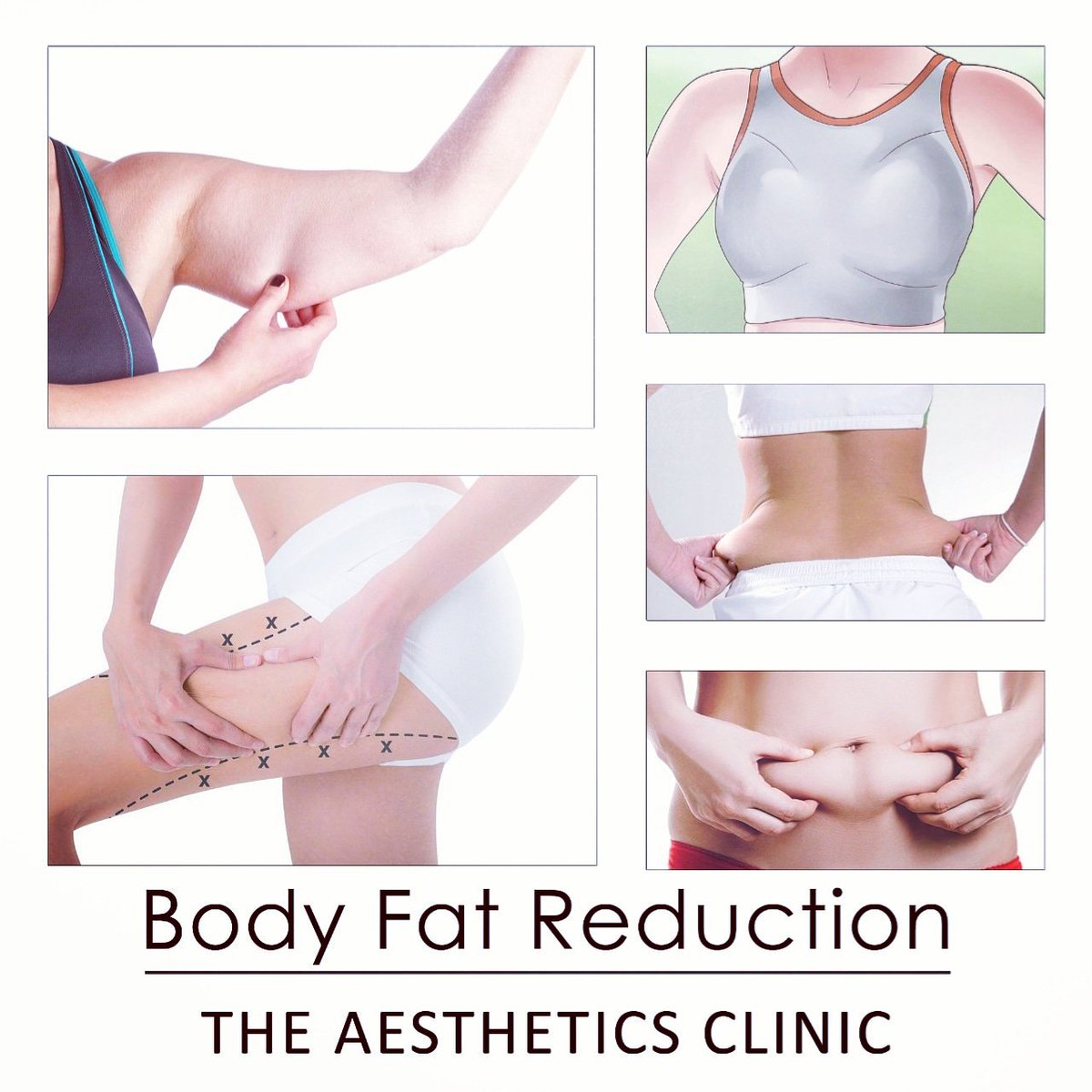 SLACPK's tweet photo. Get rid of stubborn fat #Belly #LoveHandles #Thighs #Arms #DoubleChin #Abdomen #HeavyBreasts
The Aesthetics Clinic - Dr. Shaista Lodhi.
For details and appointments call: 0321-1225719 021-38883275 DHA - Karachi.
#DrShaistaLodhi #ShaistaLodhi #fatreduction @IamShaistaLodhi https://t.co/Fuu9aVbn7U