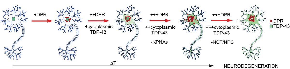 ALSResForum's tweet photo. Researchers make the case for a new therapeutic target in #ALS #MND, that plays a role in nucleocytoplasmic transport https://t.co/fgaU3AuoFQ #NuclearImport #KPNAs #disaggregases @Brain1878 https://t.co/qAOzXuOC6X