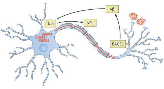NatRevNeurol's tweet photo. New online today: Blood-based biomarkers for Alzheimer disease: mapping the road to the clinic https://t.co/afZZYPWBpn #newfromnrneurology https://t.co/yiFS0VbLEp