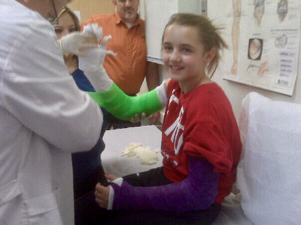 Debbie__Dungen's tweet photo. @ECUTigersVB #doublecasts. #nomoresurgeriesplease https://t.co/wGfLbg3wgv