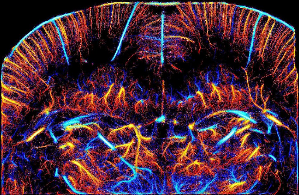 ESPCI_Paris's tweet photo. La révolution des #ultrasons biomédicaux : Avec le soutien de la Fondation Bettencourt Schueller, l'équipe #PhysMed de M. Tanter (@TanterM) va utiliser son savoir faire unique au monde pour l'#imagerie, le #diagnostic précoce et la #chirurgie non invasive
https://t.co/xj87nf3MHm https://t.co/zDBrjheaqz