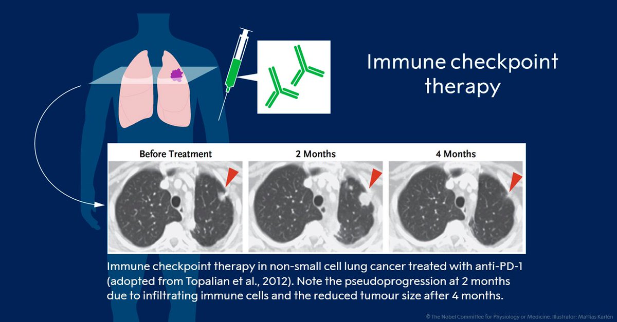 Until the discoveries made by the 2018 Medicine Laureates, progress into clinical development was modest. “Immune checkpoint therapy” has revolutionised cancer treatment and has fundamentally changed the way we view how cancer can be managed.

#NobelPrize