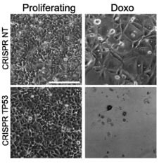 BreastCancerResearch tweet media