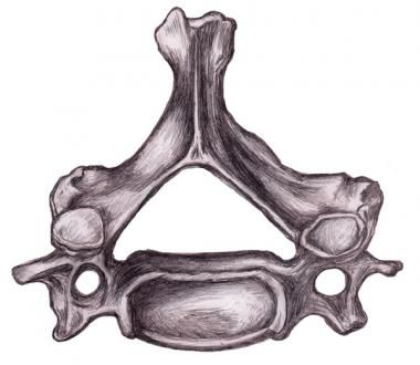 Rad_Bits's tweet photo. Medscape cervical spine anatomy
https://t.co/5zeSbXRiJu
#radiology #kku_med #uqumed #UQUMed35 #bu_medicine #radres #medicnina #radiologie @medicine_bu @guide1_me @OneMedZone @educaring_sa #med15 #med16 #med17 #fSMLE #USMLE1 #USMLE2 #OrthopedicSurgery #radiologycase https://t.co/u12q89Zd7l