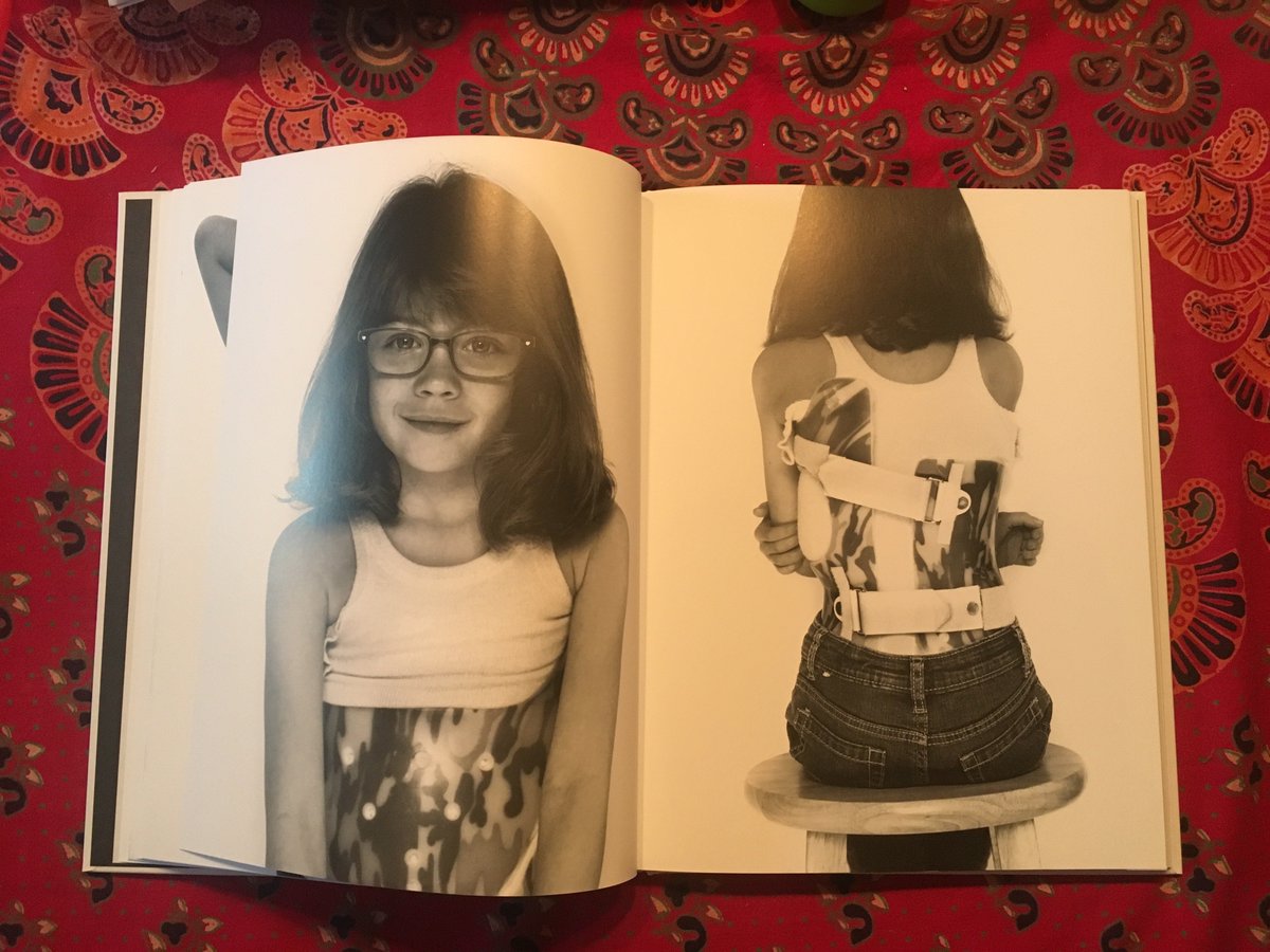beFited's tweet photo. At @beFited, we are inspired with the bravery, courage, &amp; artistic ability of #SyndeeLubar telling her &amp; 28 other #scoliosis warriors stories in her elegant book #Spines to benefit #nationalscoliosisfoundation non-profit founded by #JoeOBrien.  Get yours: https://t.co/nwSve7hEZA https://t.co/FSbdFeT4of