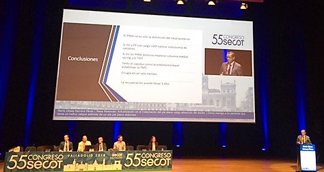 semcpt1's tweet photo. Y enhorabuena a los ponentes de dicha excelente mesa "Actualización en el Tratamiento del Pie Plano Valgo Adquirido del Adulto" #SEMCPT #SECOT2018: Dra. Sánchez, Dr. Herrera, Dr. Tejero y Dr. Poggio!!!

@soycot @secot18 @EFORTnet @EFASnews @aeartroscopia @semcpt1 https://t.co/taFIxyC0bU