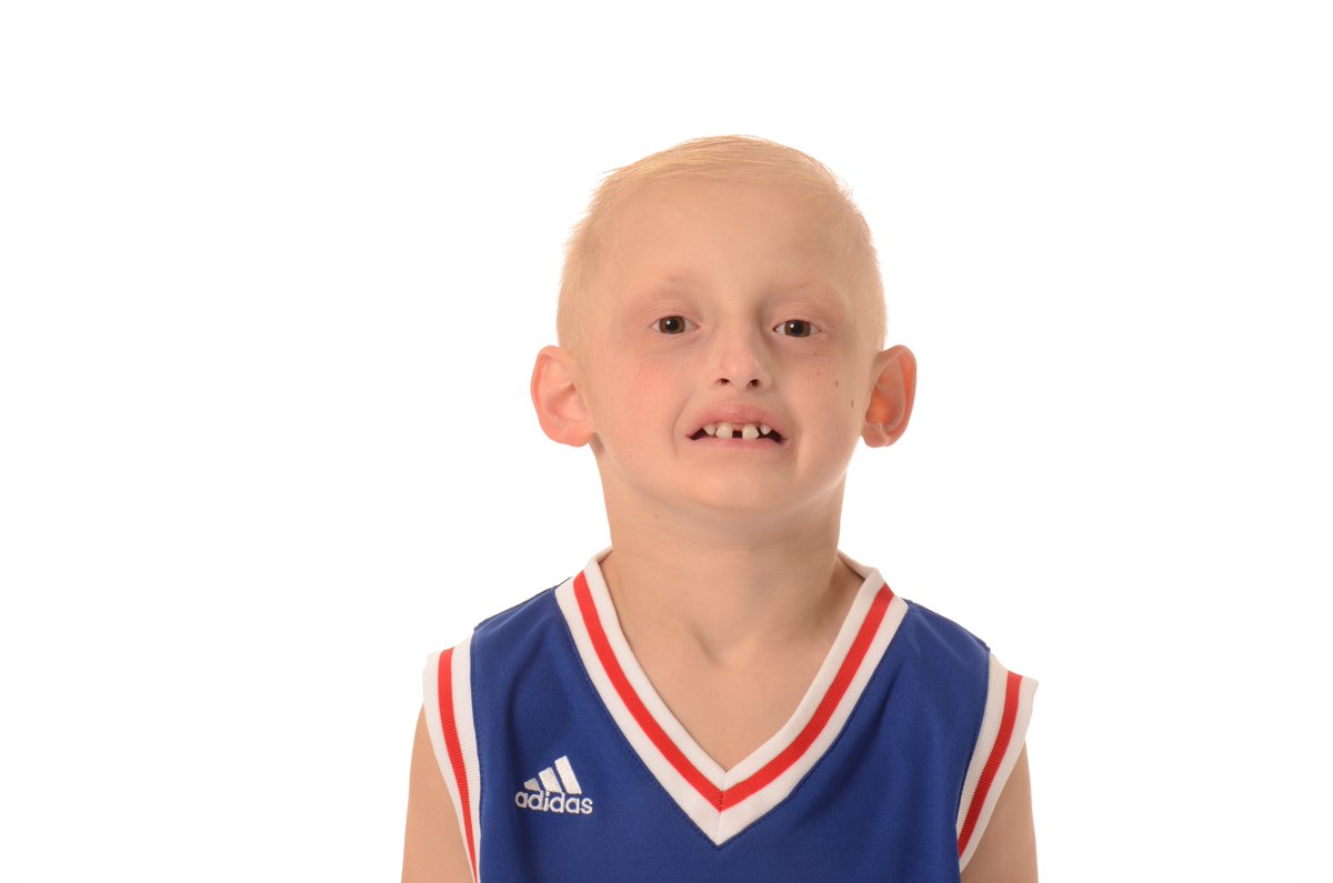 NFED_ORG's tweet photo. A6 Write your legislators. Ask them to co-sponsor the Ensuring Lasting Smiles Act. People with ectodermal dysplasia deserve medical insurance benefits to replace or restore teeth missing due to congenital anomaly. #oralhealthishealth #fallforsmiles https://t.co/0H9yk3GIpc https://t.co/v0ty6vKgZA