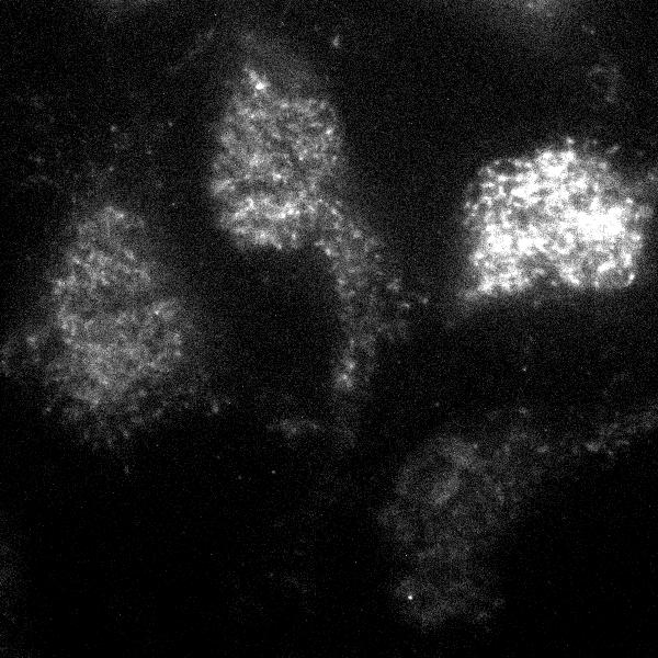 Photometrics's tweet image. Big thanks to Simon Watkins for sharing with us how they&apos;re using the #Prime95B for TIRF imaging at the University of Pittsburgh. Here, they investigate how inositol lipids effect membrane function and transport of nutrients in disease:
photometrics.com/resources/cust…