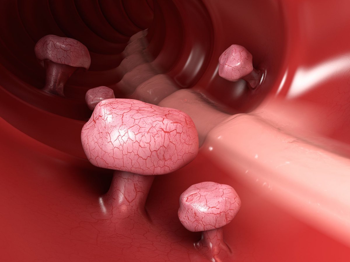 Colorectal Cancer Alliance tweet media